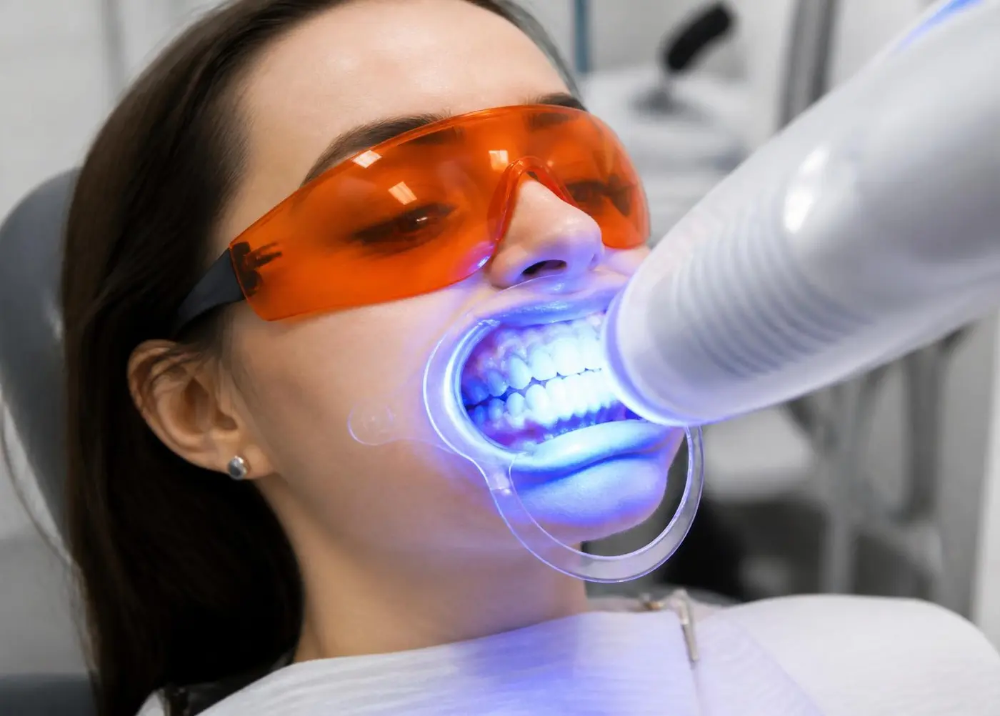 Teeth Whitening